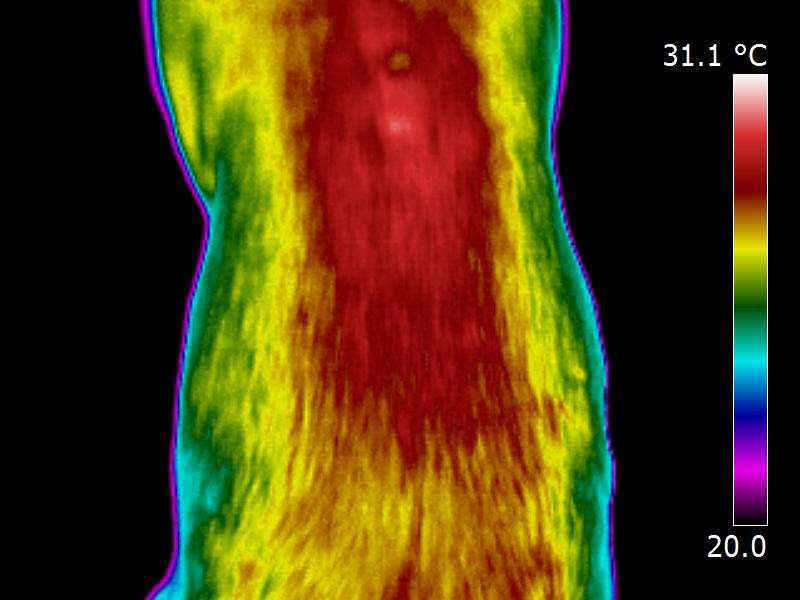 Spinal Thermal Image